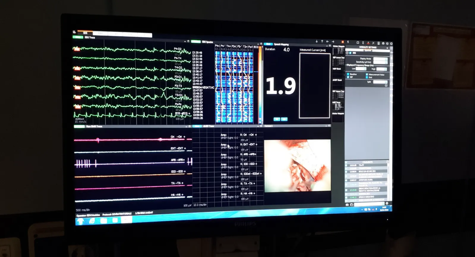 monitoraggi intrafisiologici